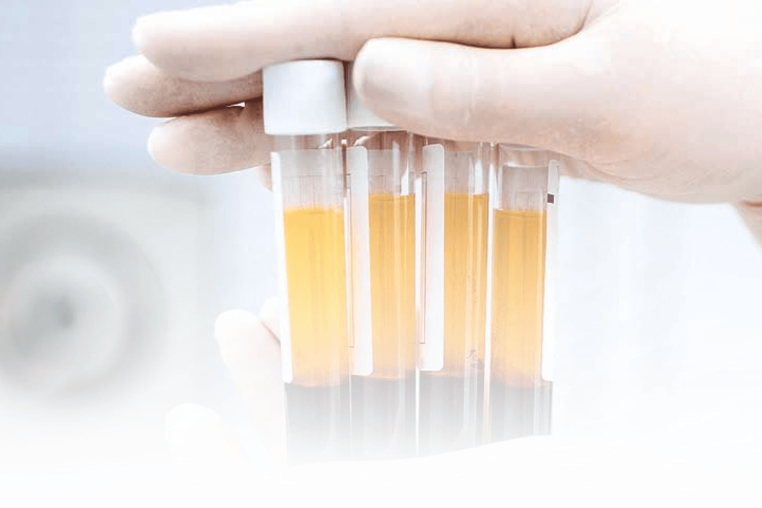 Brasil amplia armazenamento de plasma e reduz dependência