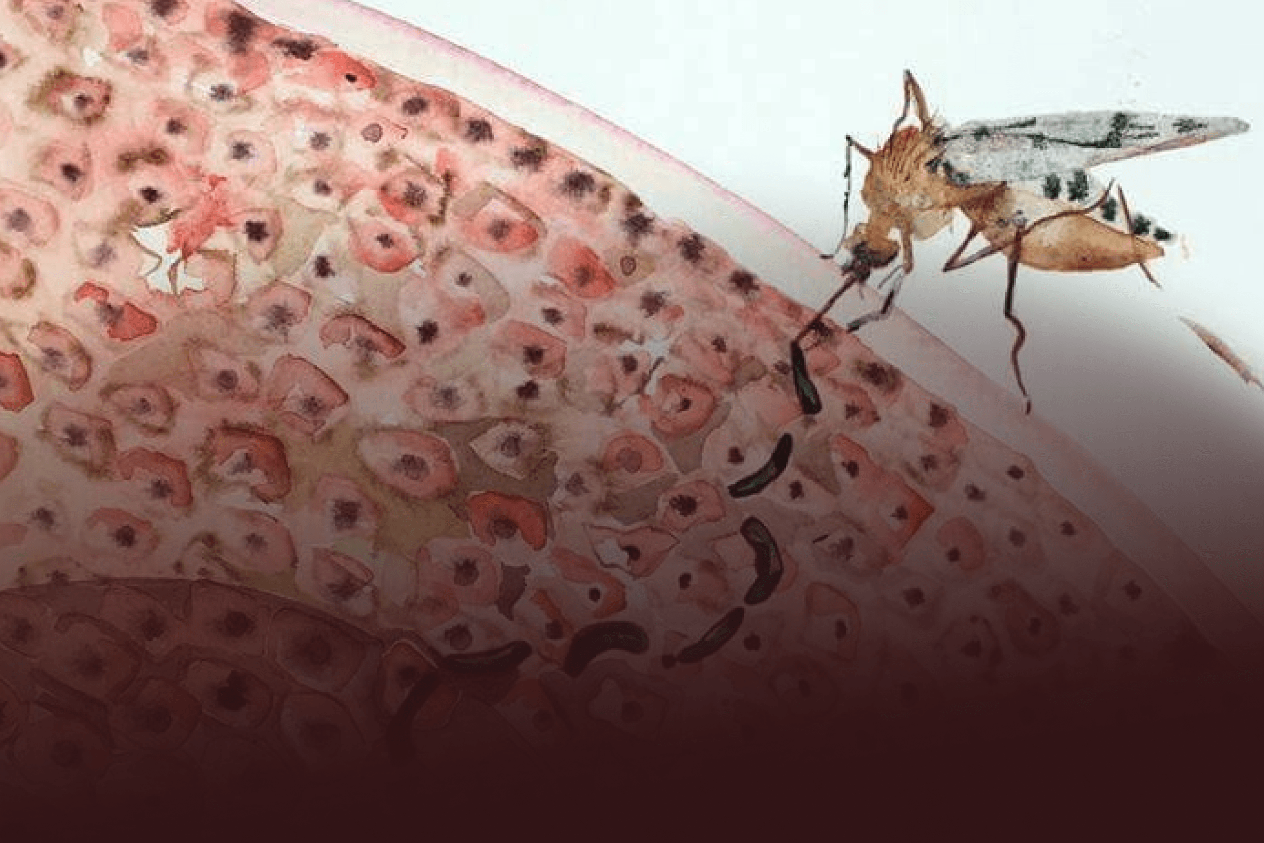 Malária no Brasil: Avanços em Tratamento Acessível e Monitoramento