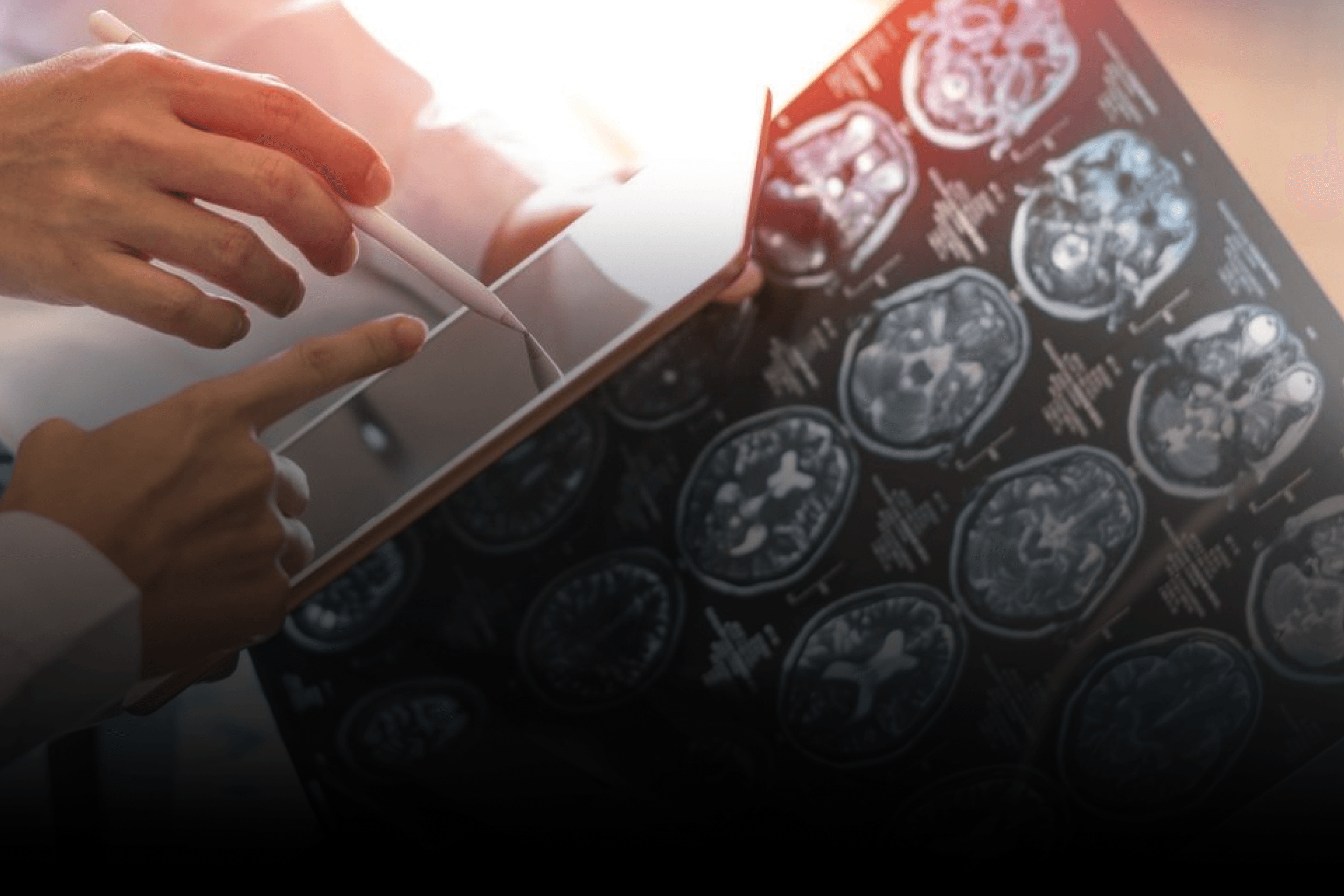 IA agiliza decisões clínicas em oncologia no Brasil